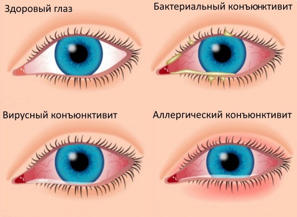 к1